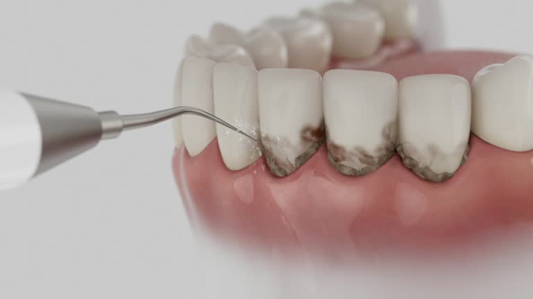 Trusted Dental Implants service in Rogers City, MI - Dentist Open Now
